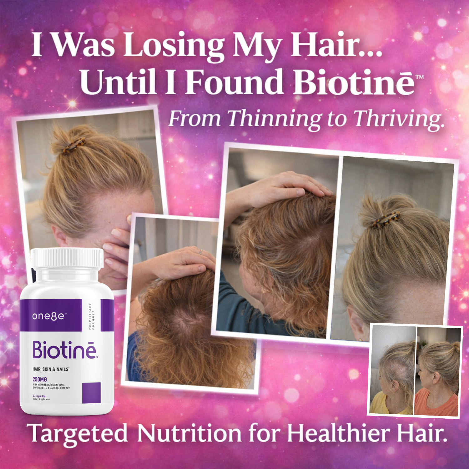 Biotinē - Perimenopause